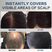 Hair Shadow Powder Instantly Conceals Hair Loss Hairline Powder for Women & Men